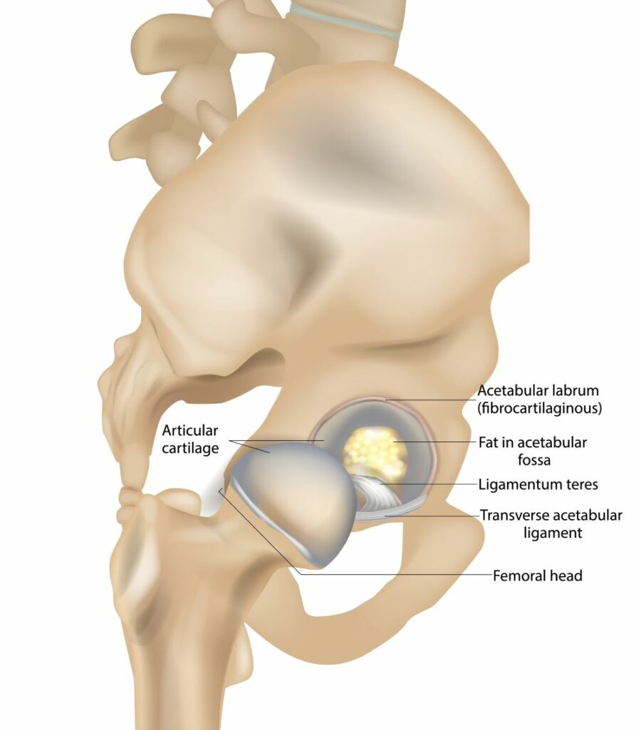 Diagram showing the anatomy of the hip joint, including the ligamentum teres, acetabular labrum and femoral head